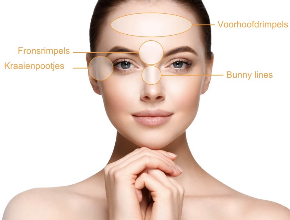 Botox behandeling Amsterdam